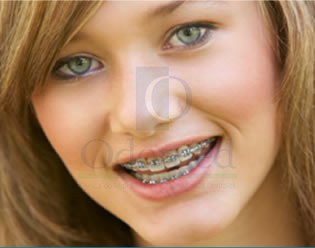 Orthodontics